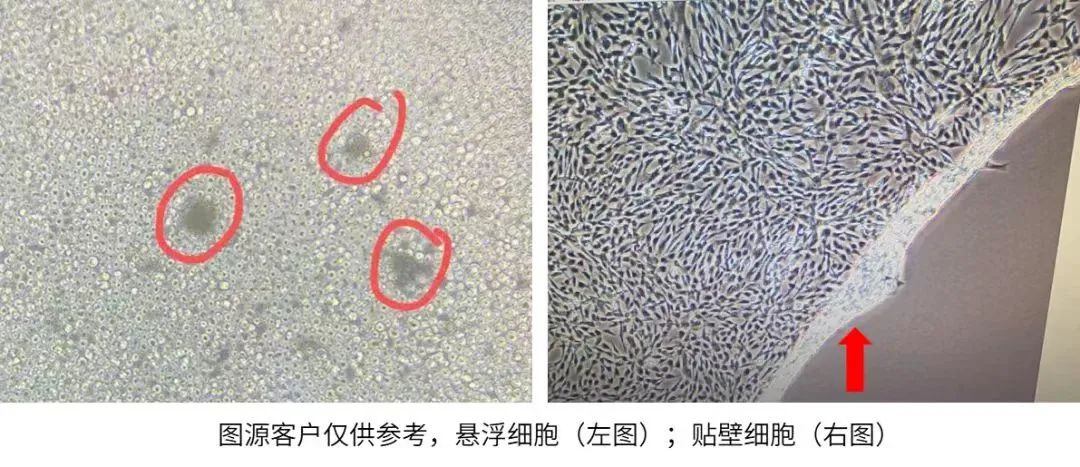 懸浮細胞和貼壁細胞
